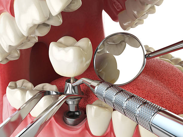 Best Urgent Tooth Repair  in Swartz, LA